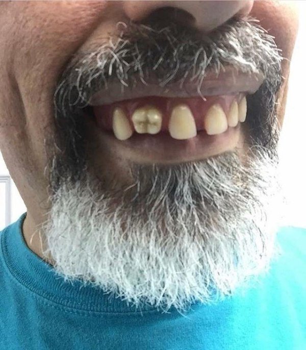 люди с гнилыми зубами