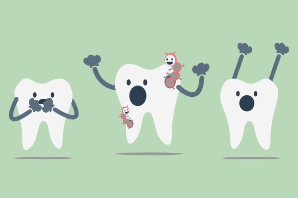 кариес вектор