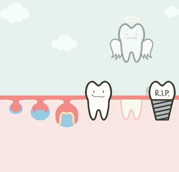 рисунки зубов