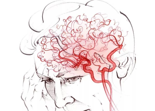 сосуды головного мозга
