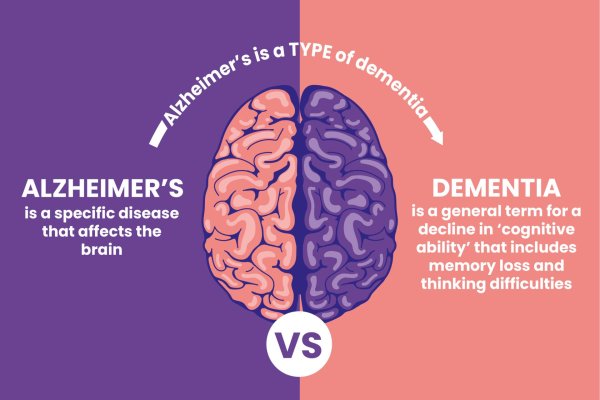 alzheimers symptoms