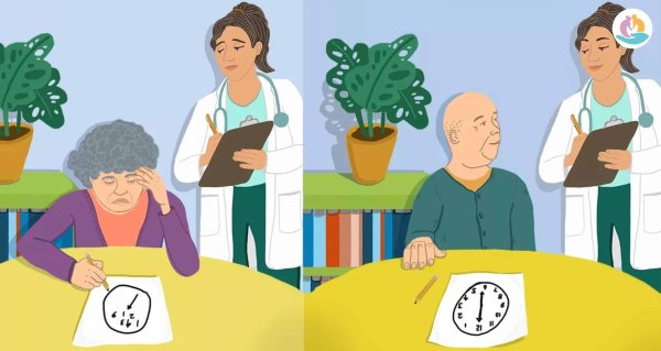 тест на деменцию