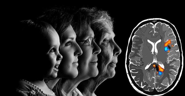 старение мозга