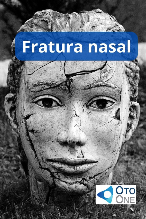 голова статуи