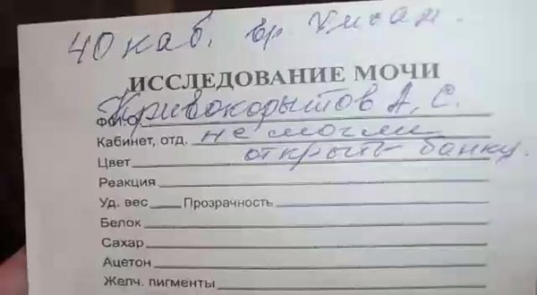 исследование мочи