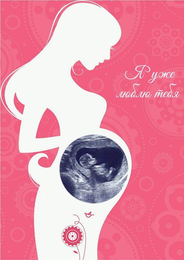 рамка для узи