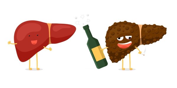 alcoholic hepatitis