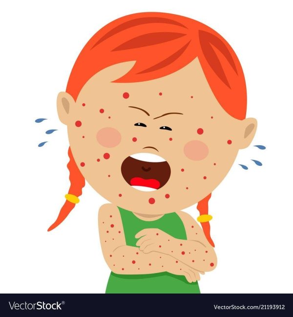 ветряная оспа