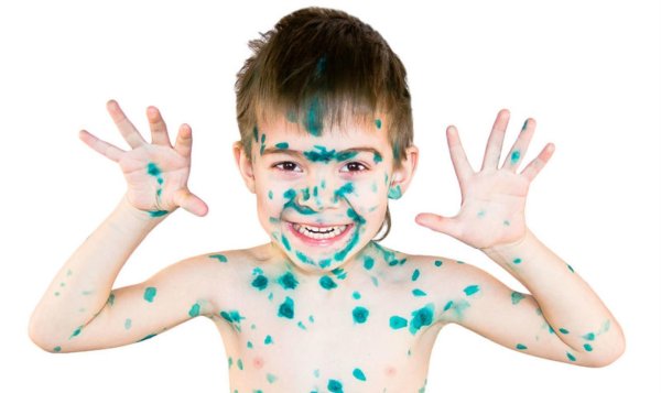 ветрянка зеленка