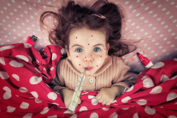 ветрянка детей