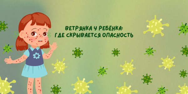 меры профилактики ветряной оспы