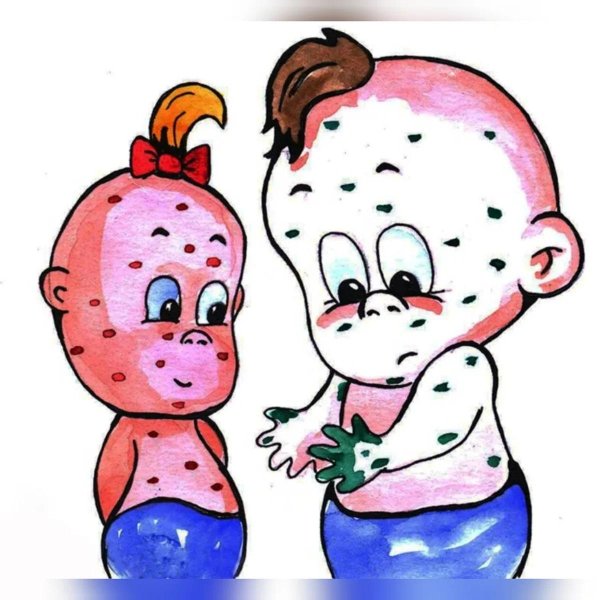 ветрянка детей