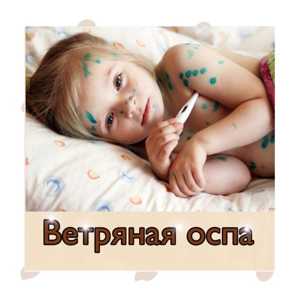 ветряная оспа