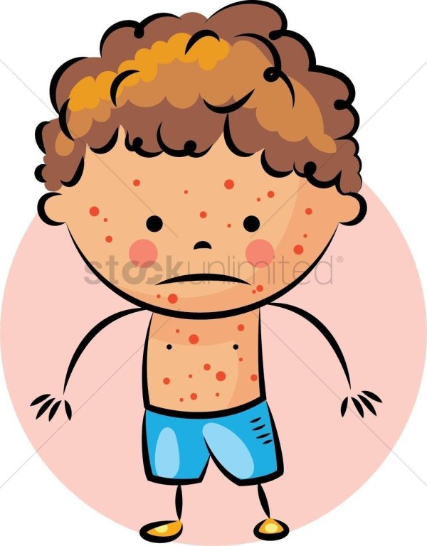 ветрянка рисунок