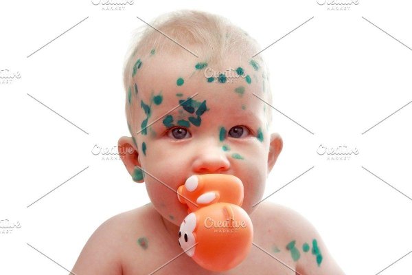 ветряная оспа