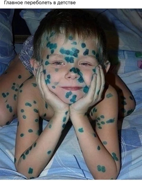 ветрянка фукорцин