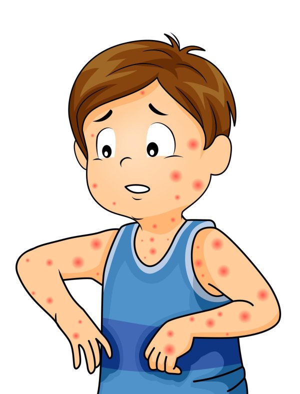 корь рисунок