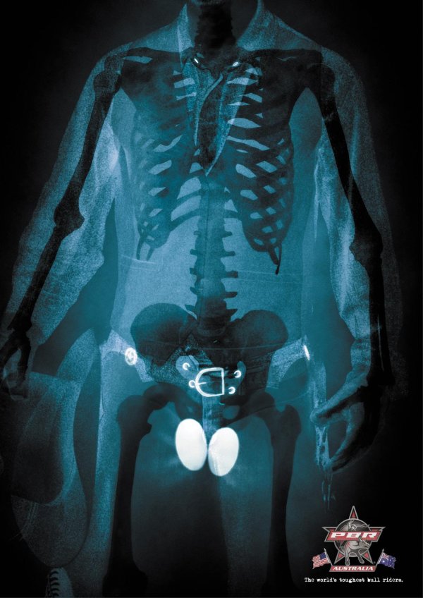 прикольный рентген