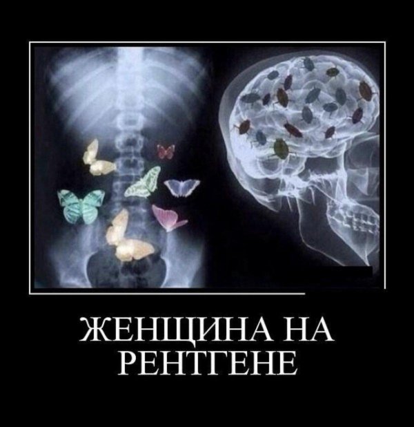 бабочка в животе