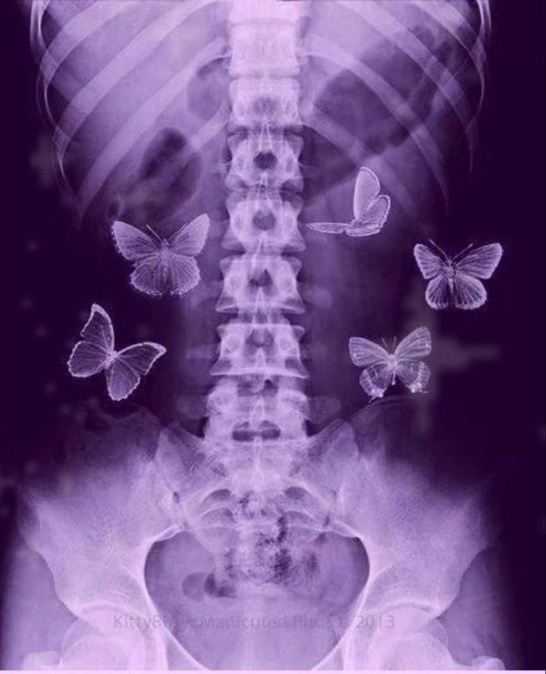 бабочка в животе