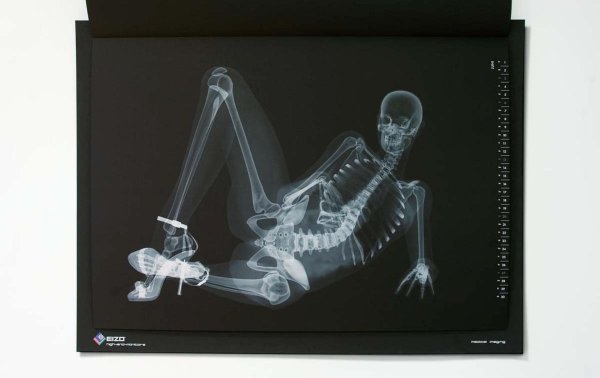 рентгенсканер 2xr51