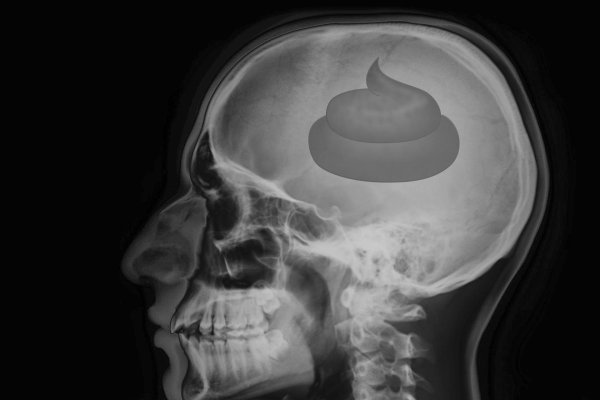 рентгеновские снимки