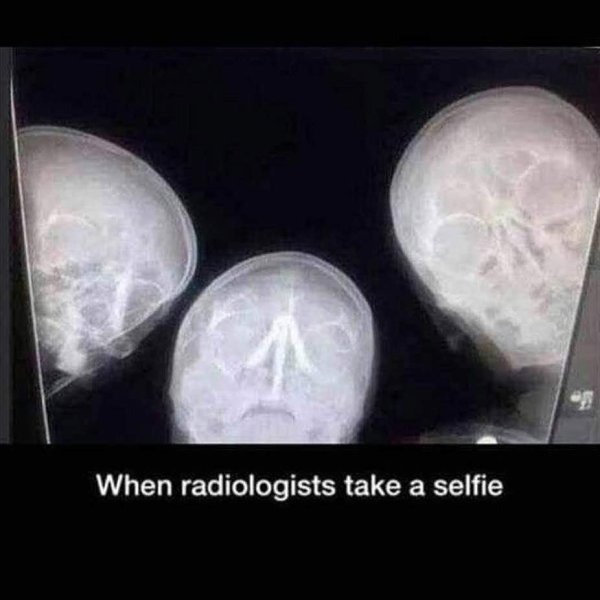 селфи рентгенологов