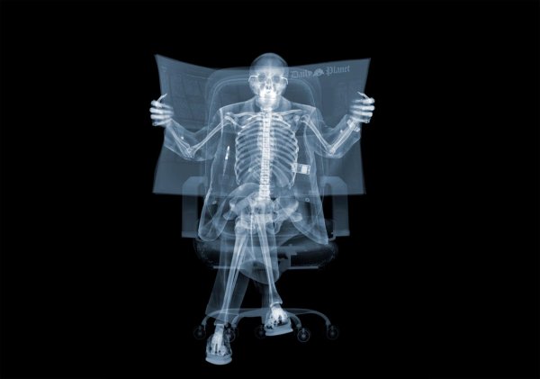 x ray рентген