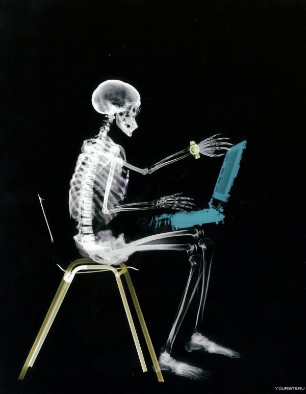 рентгеновский снимок человека