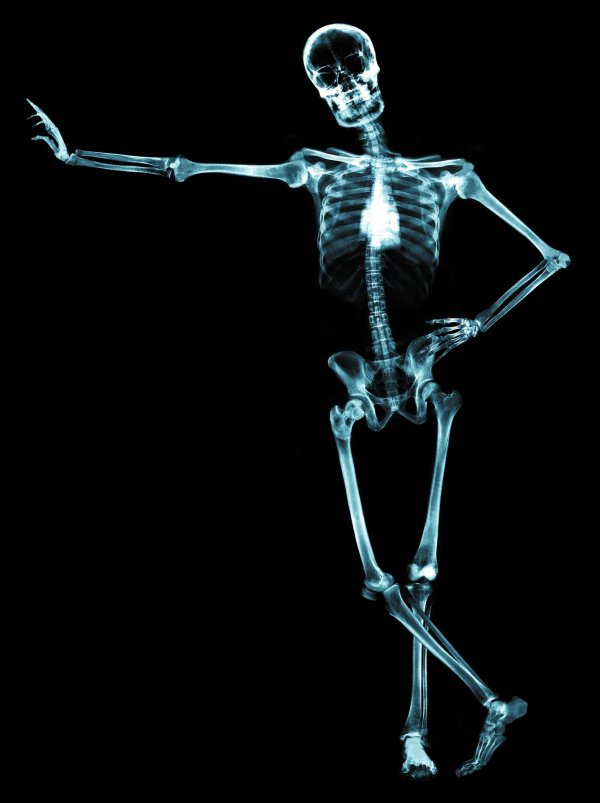 снимок скелета