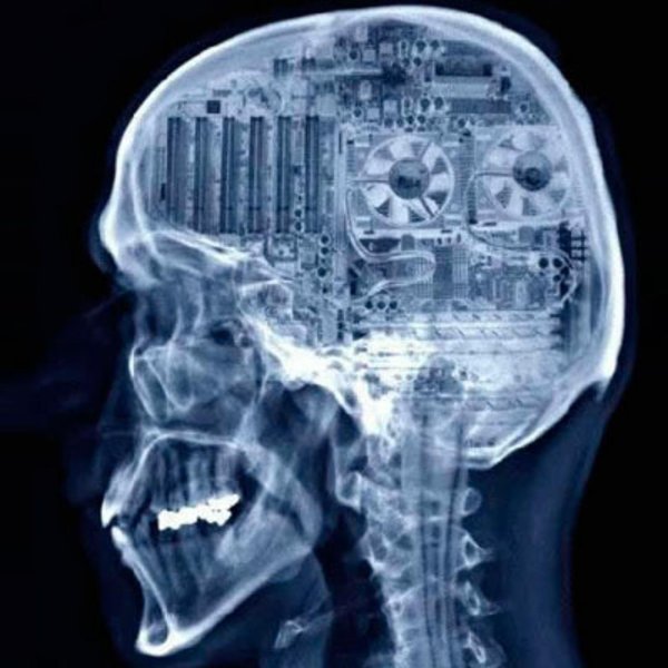 рентген головы