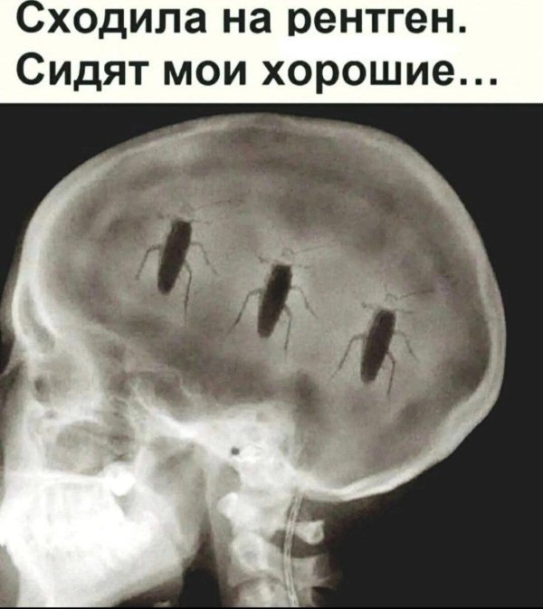 таракан в голове