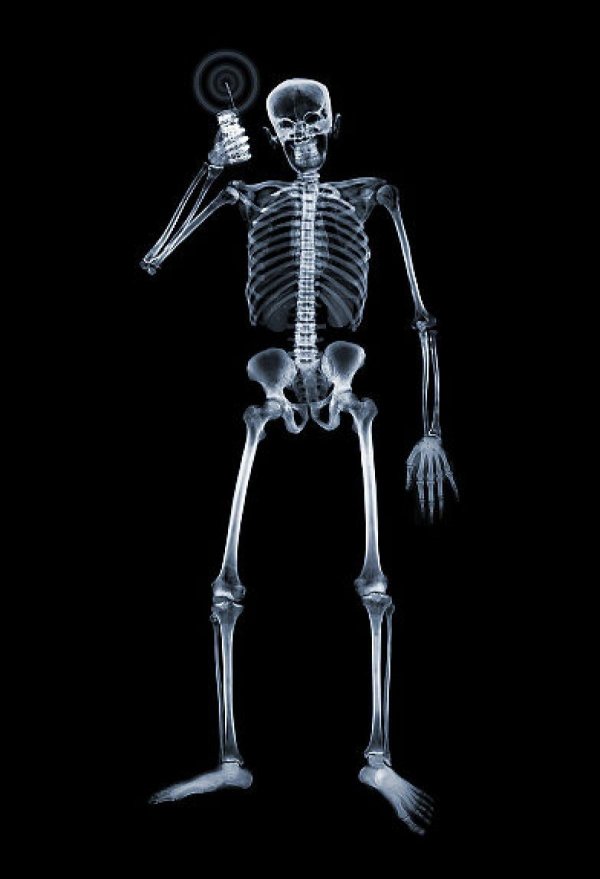 снимок скелета