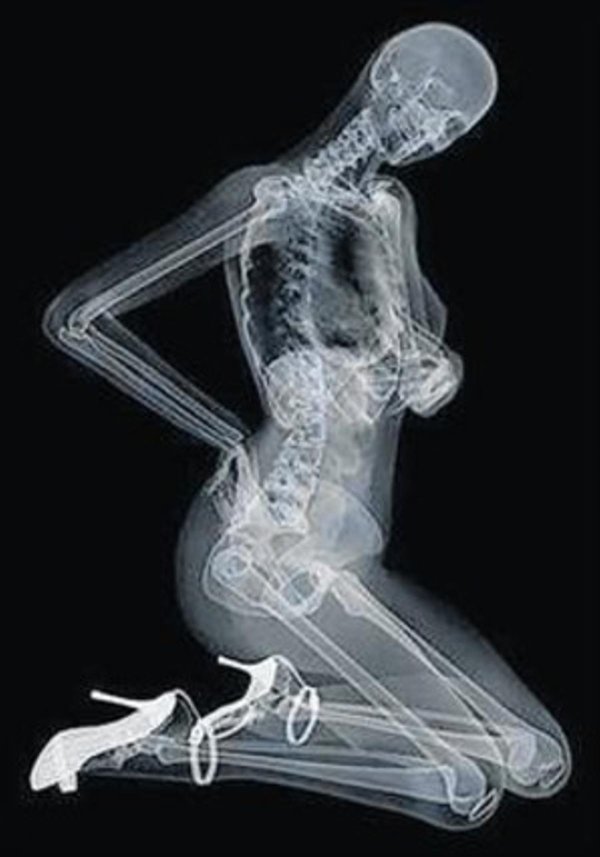 рентгеновские снимки девушек