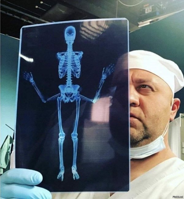 снимок скелета