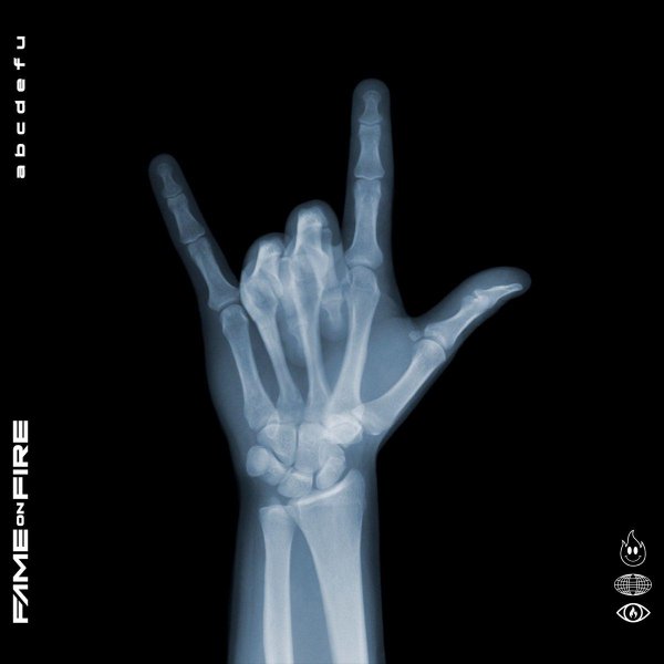 рентгеновские лучи