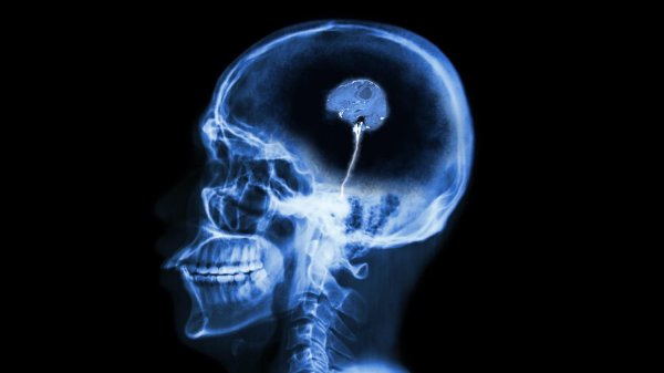 мозг маленький