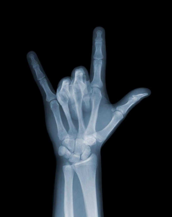 рентгеновский луч