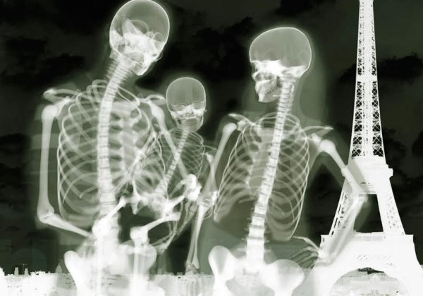 человека скелет