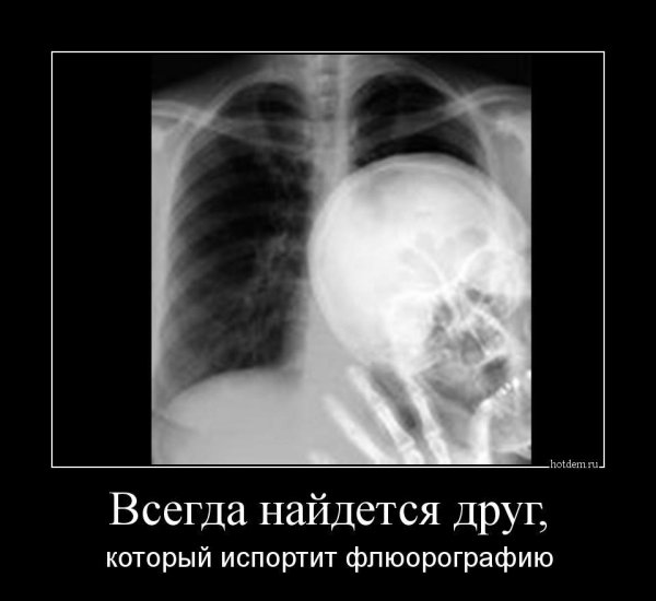 легкие на рентгене