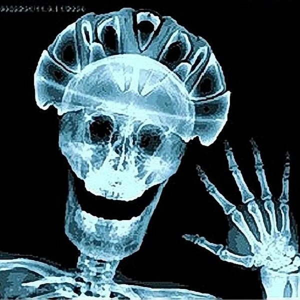 рентгеновские лучи радиация