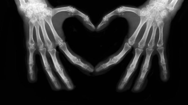 рентгеновский снимок