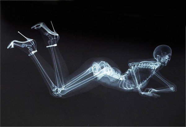 скелет девушка