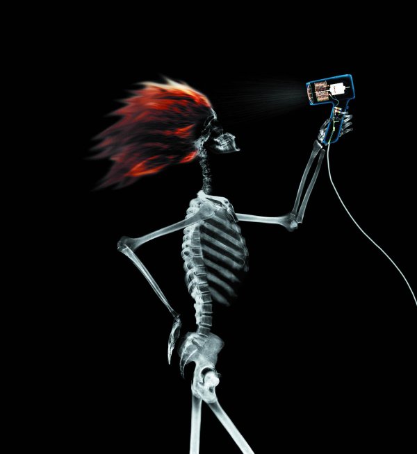 живой скелет