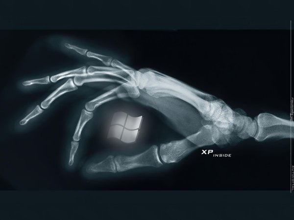 рентгеновские снимки