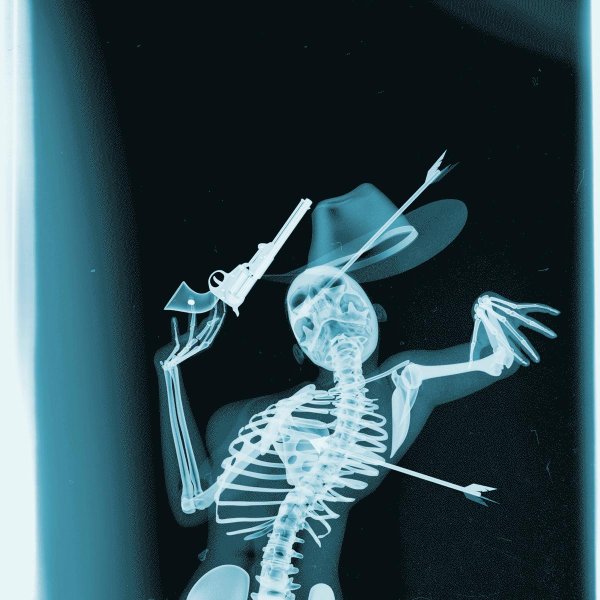 снимок скелета