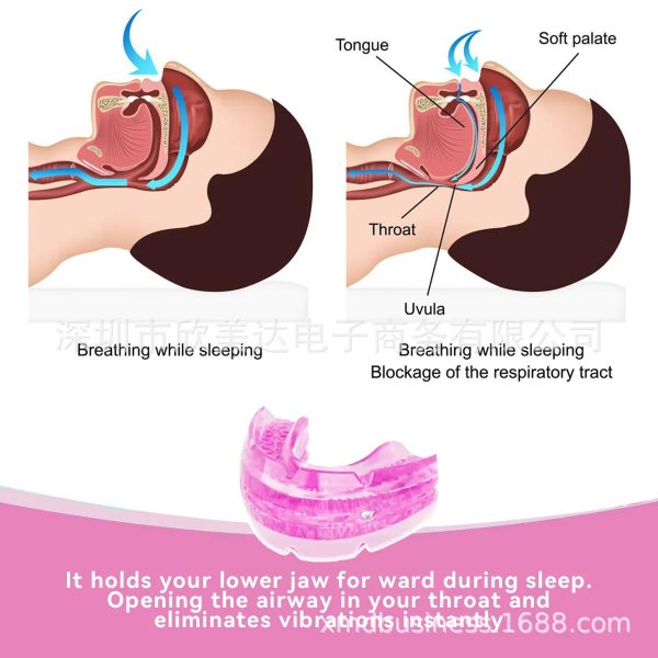 трейнер миобрейс