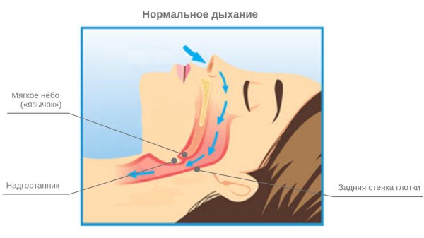 мягкое небо