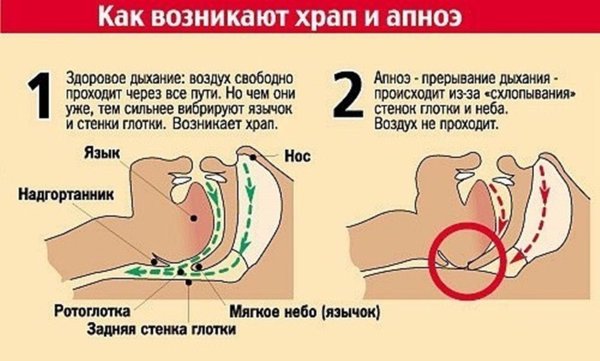 почему люди храпят во сне причины