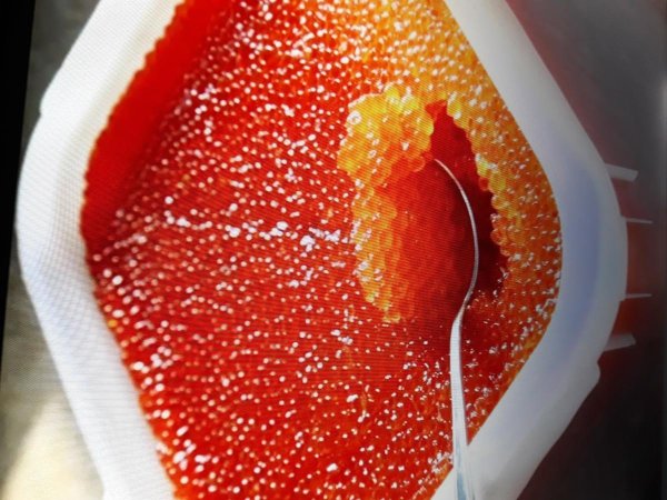 икра горбуша